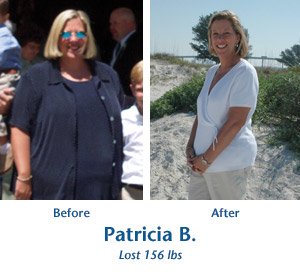 Patricia B. before and after